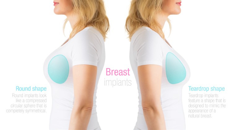 What Do the Perfect Boobs Look Like - Breast & Body Clinic UK