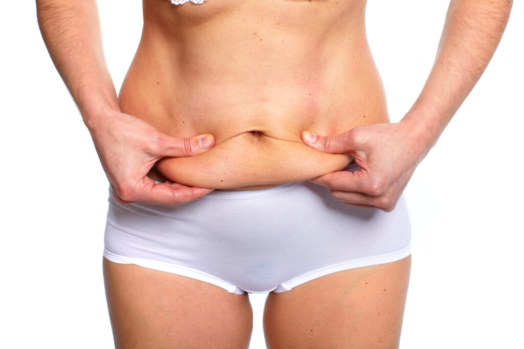 Say goodbye to insecurities and embrace the beauty of the Fleur de Lis Tummy Tuck.