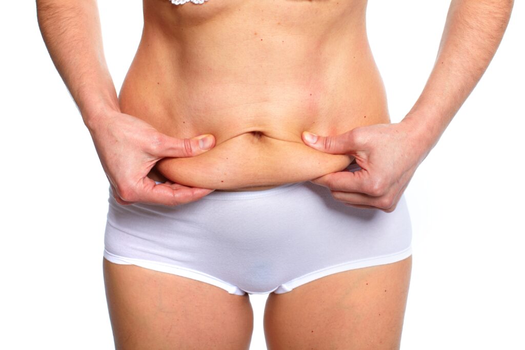 Fleur de lis Abdominoplasty Surgery - Manchester