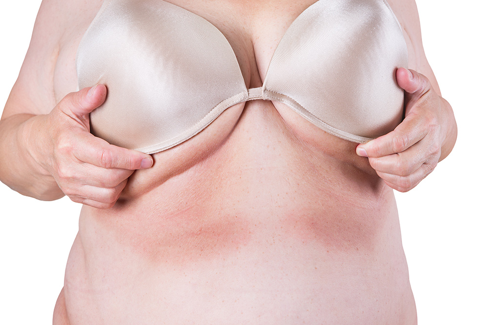 How do large breasts cause back pain