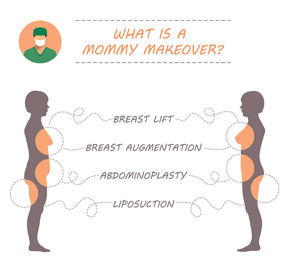 What Does a Mummy Makeover Include