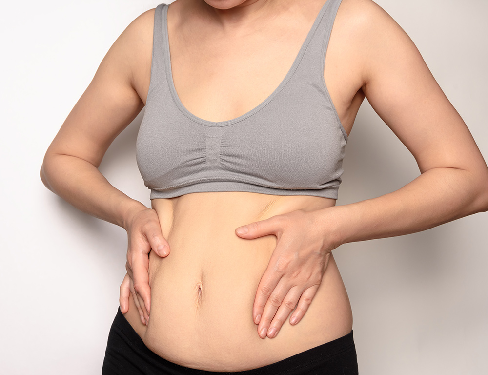 Body After Pregnancy | Post Pregnancy Belly | Postpartum Body Changes | Stretch Marks After Pregnancy